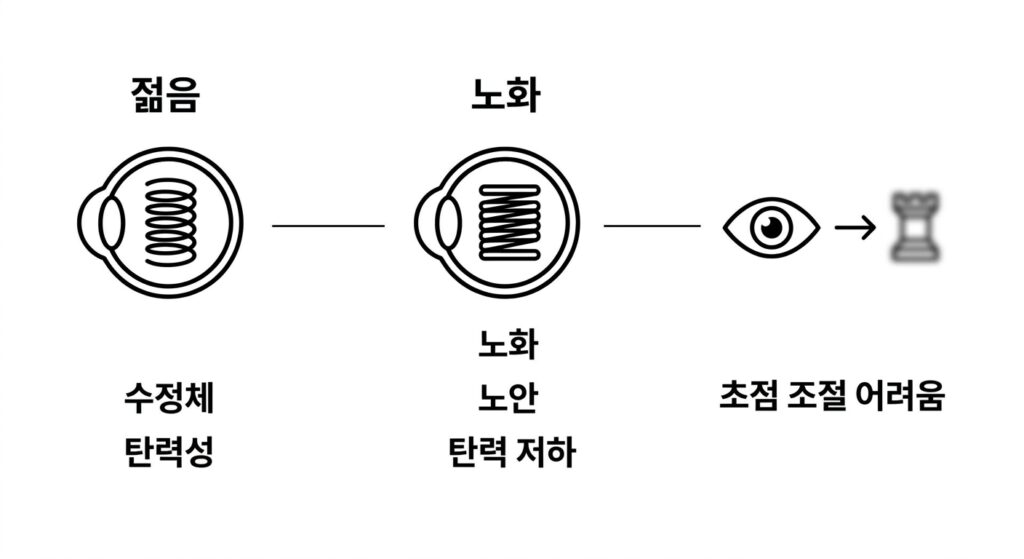 노안이란? 수정체가 딱딱해지는 것