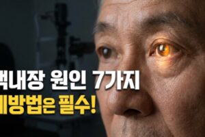 백내장 원인 7가지와 예방법, 노화 외에도 이런 이유가?